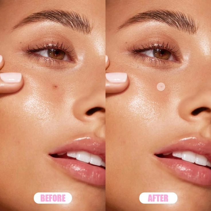 Centella Clearing Spot Patch