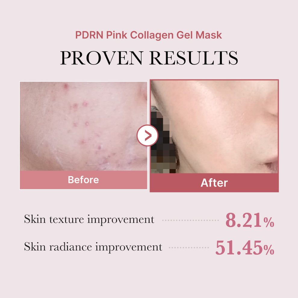Salmon PDRN Pink Collagen Jelly Gel Mask - Medicube