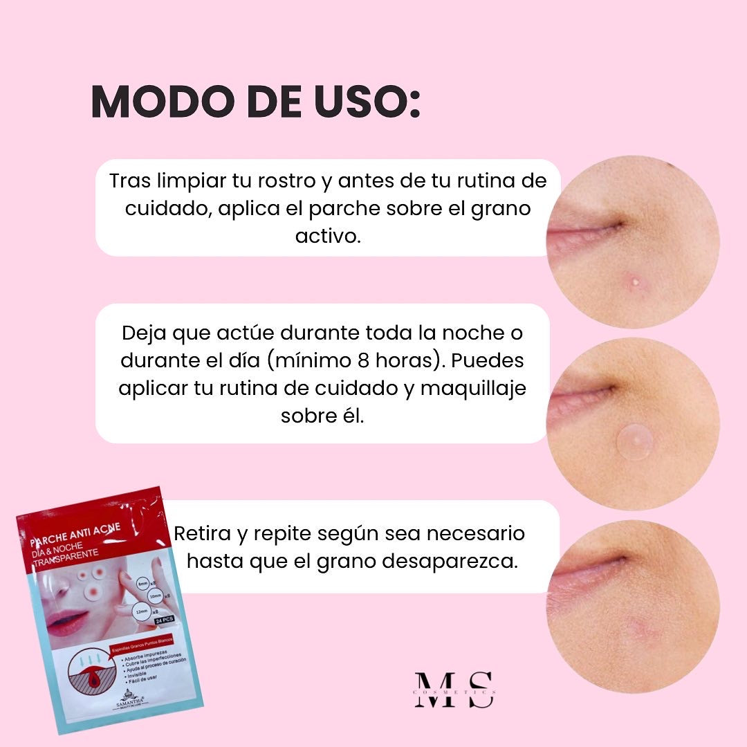 Parches Invisibles para Acné/Espinillas Facial - Dr.La Rosa